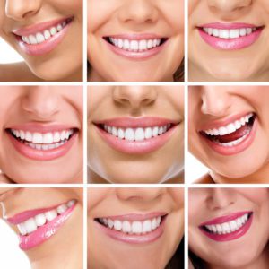 Invisalign in Dubai- Cost - Deira Dental Clinic