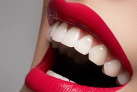 Hollywood Smile in Dubai - Best Dentist deira Dubai - Cheapest and Best Veneers in Deira