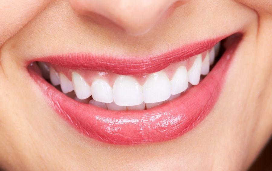 Braces in Dubai At AED 500 monthly - Braces Cost - Orthodontix